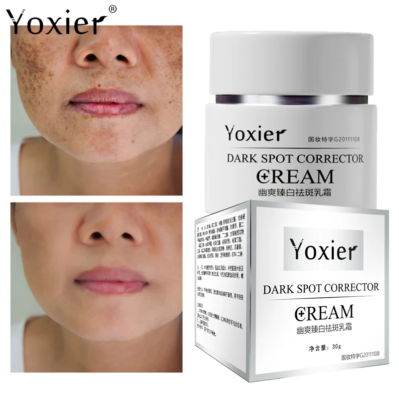 Freckle Cream Remove Facial Spots Moisturizing And Whitening Even Skin Tone Anti-Aging Deep Nourishment Repair Facial Care 30g