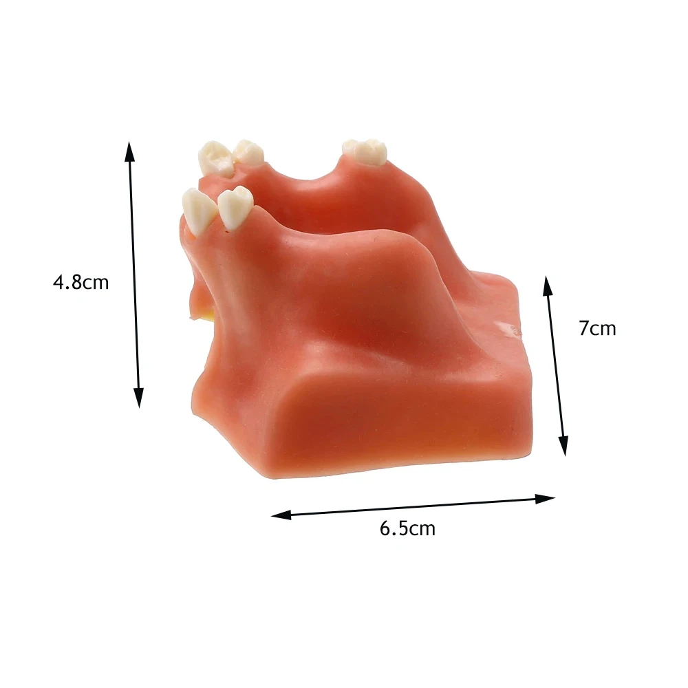 1pcs Resin Maxillary Teeth Model Upper Jaw Sinus Lift Implants Restoration Dental Practice For Medical Teach Study Demonstration