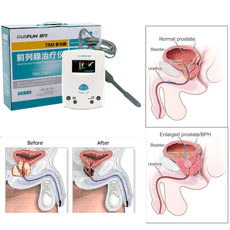 Prostate Massager Treatment Apparatus Infrared Heat Therapy Physiotherapy Urinary Frequency Hyperplasia Inflammation Health Care