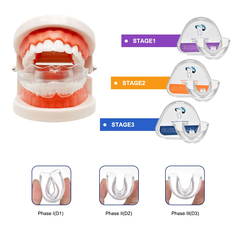 Silicone Ortodôntico Dental Cintas Sorriso Dentes Alinhamento Trainer, Retentor Instantâneo Protetor de Boca, Bandeja de Dentes