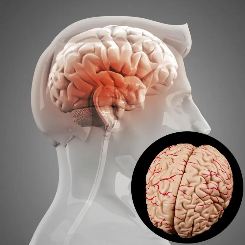 Imagem -06 - Modelo Anatômico do Cérebro Humano Desmontado Ferramenta de Ensino de Medicina