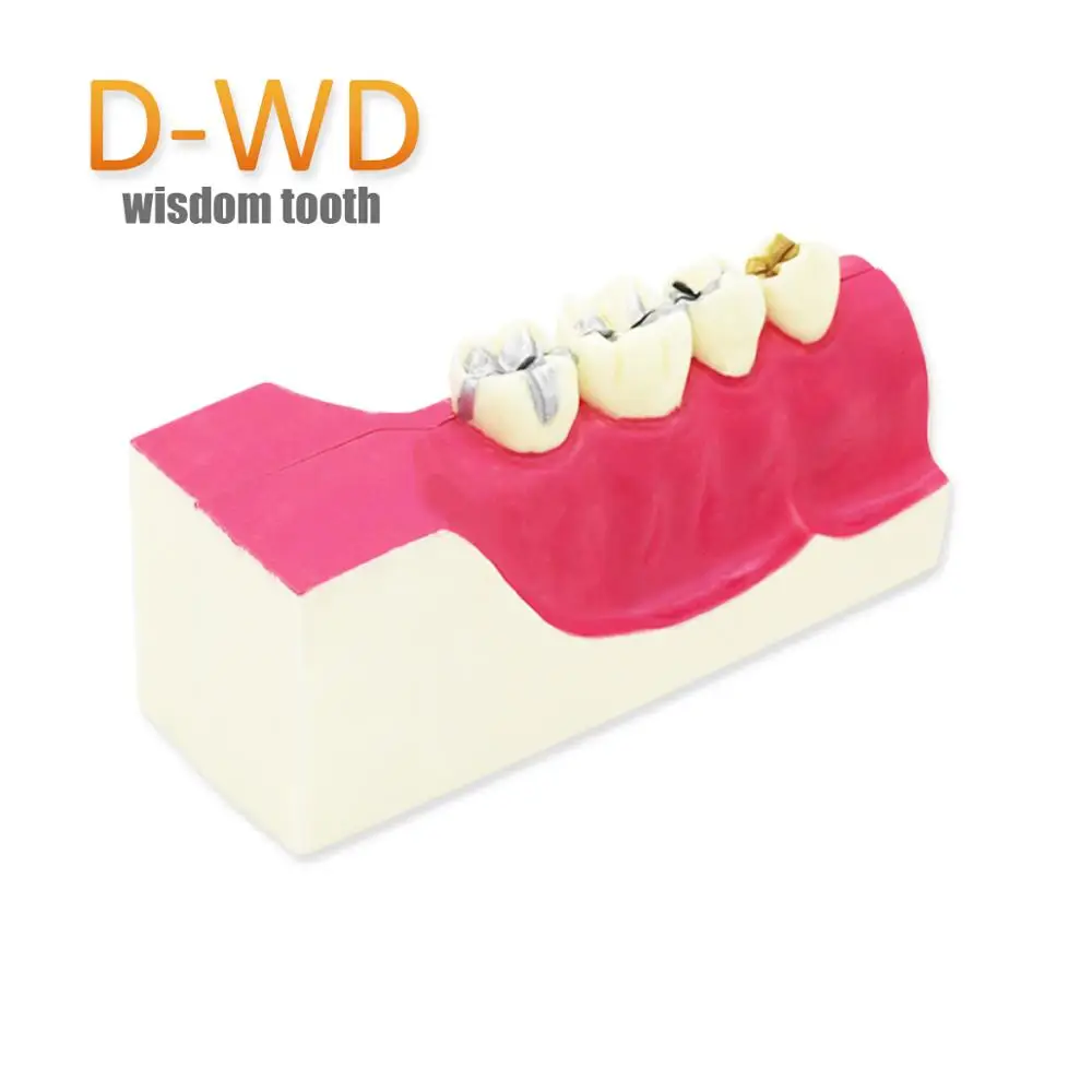 

D-WD Teeth Model Dentist student Model for Teaching Dentist Tools Dental Lab Model Caries 6 times tooth