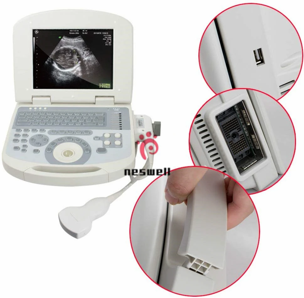 Veterinary 10 Inch Lcd Notebook B Ultrasound Scanner NS2200VET