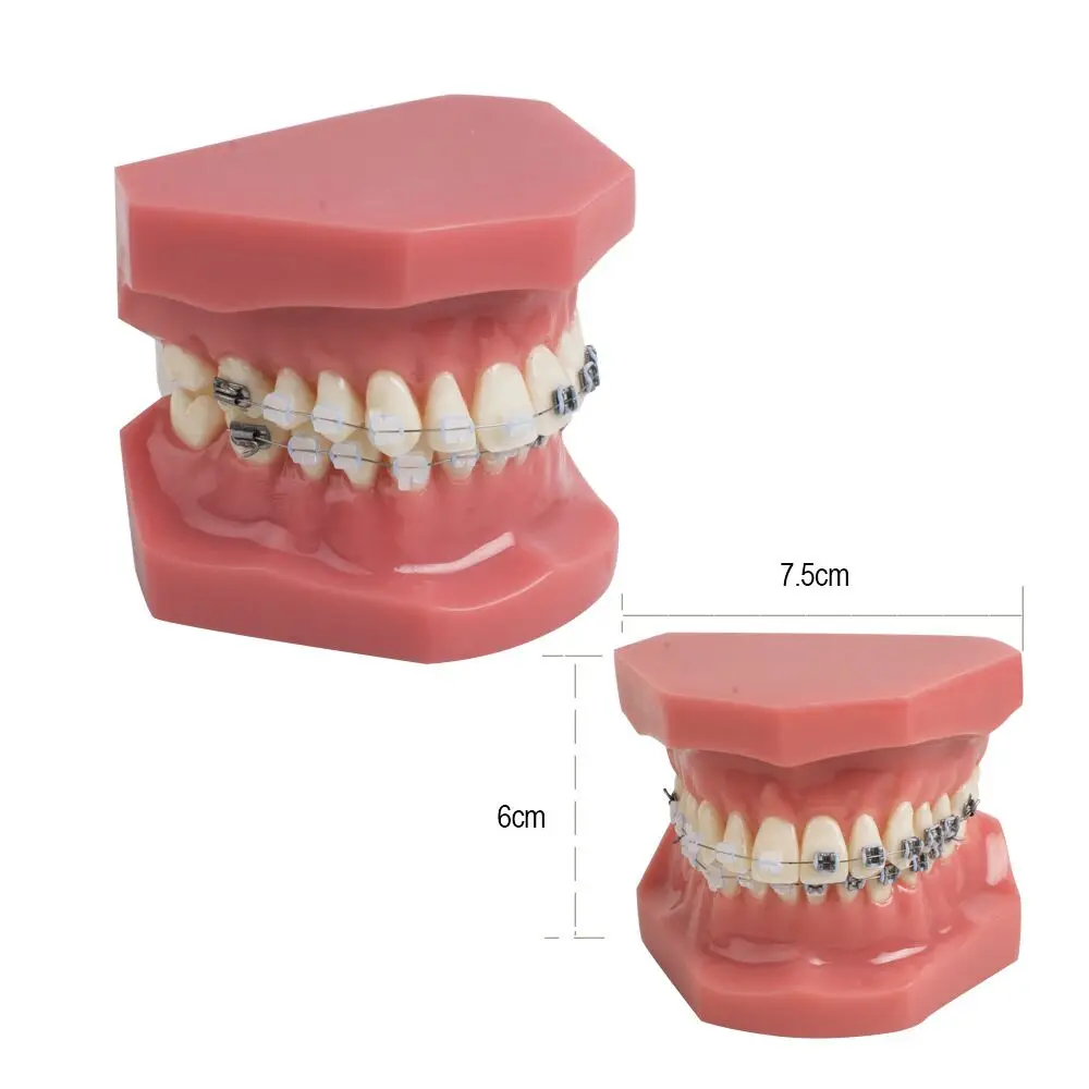 Dental Model With Braces Dentistry Materials Orthodontic Models Gum Tooth Teeth Model For Studying Teaching Patient Education