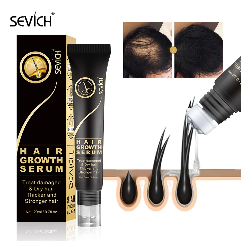 Sevich Natural Hair Growth Oil Anti Hair Loss Care Scalp Massage Roller Treatment Thickener Essence Fast Grow Hair Serum Product