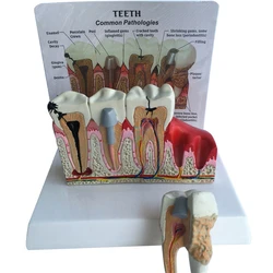 1pcs Dental Tooth Teeth Anatomical Model  Dental Anatomy Teeth Model Oversized Anatomy