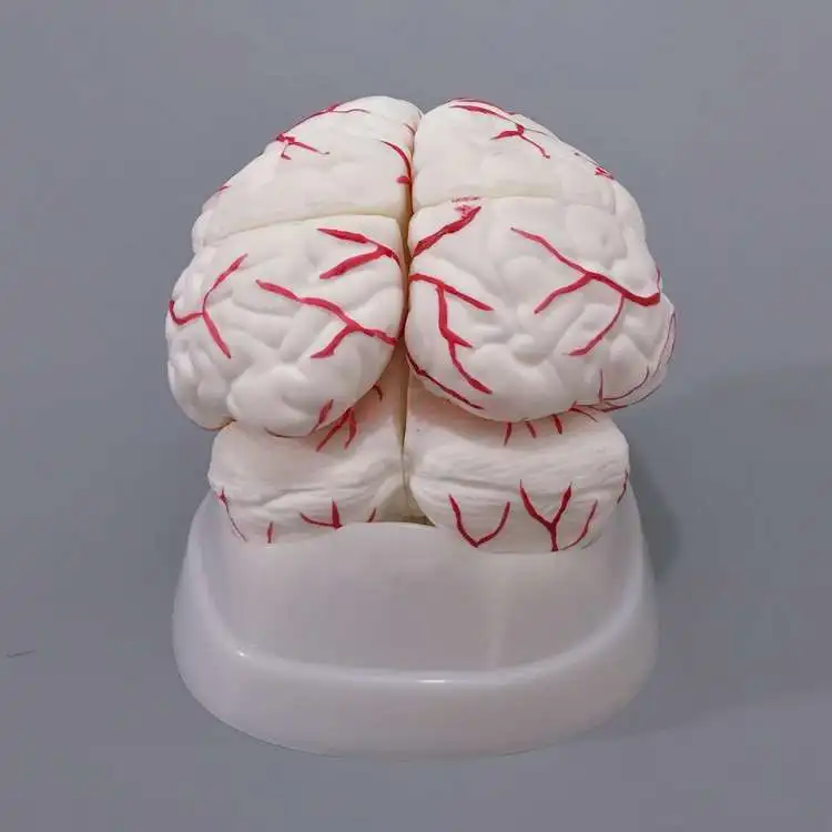 Cerebral artery model with eight detachable brain structures for cerebellar stem anatomy teaching