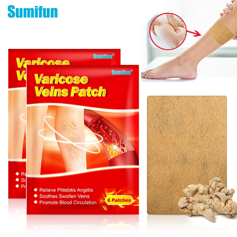 

12/24 pcs Sumifun Varicose Veins Treatment Angiitis Plaster Vasculitis Swelling Patch Phlebitis Spider Leg Herb Medical Plaster