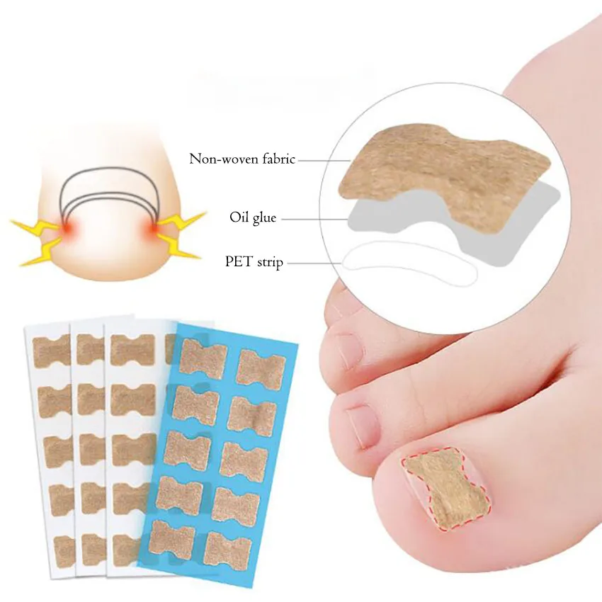 1 Set 10 In 1 Glue-free Nails Orthopedic Stickers Pedicure Toenail Groove Ingrown Nail Corrector Toenail Patch Foot Care Tools