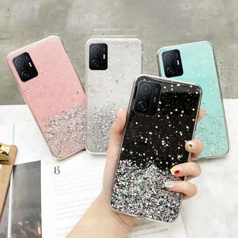 For XIAOMI 11T 11 T  Plating Soft Case TPU Phone Back Cover For XIAOMI 11T PRO 11 T PRO 11Tpro  Protection Case Coque