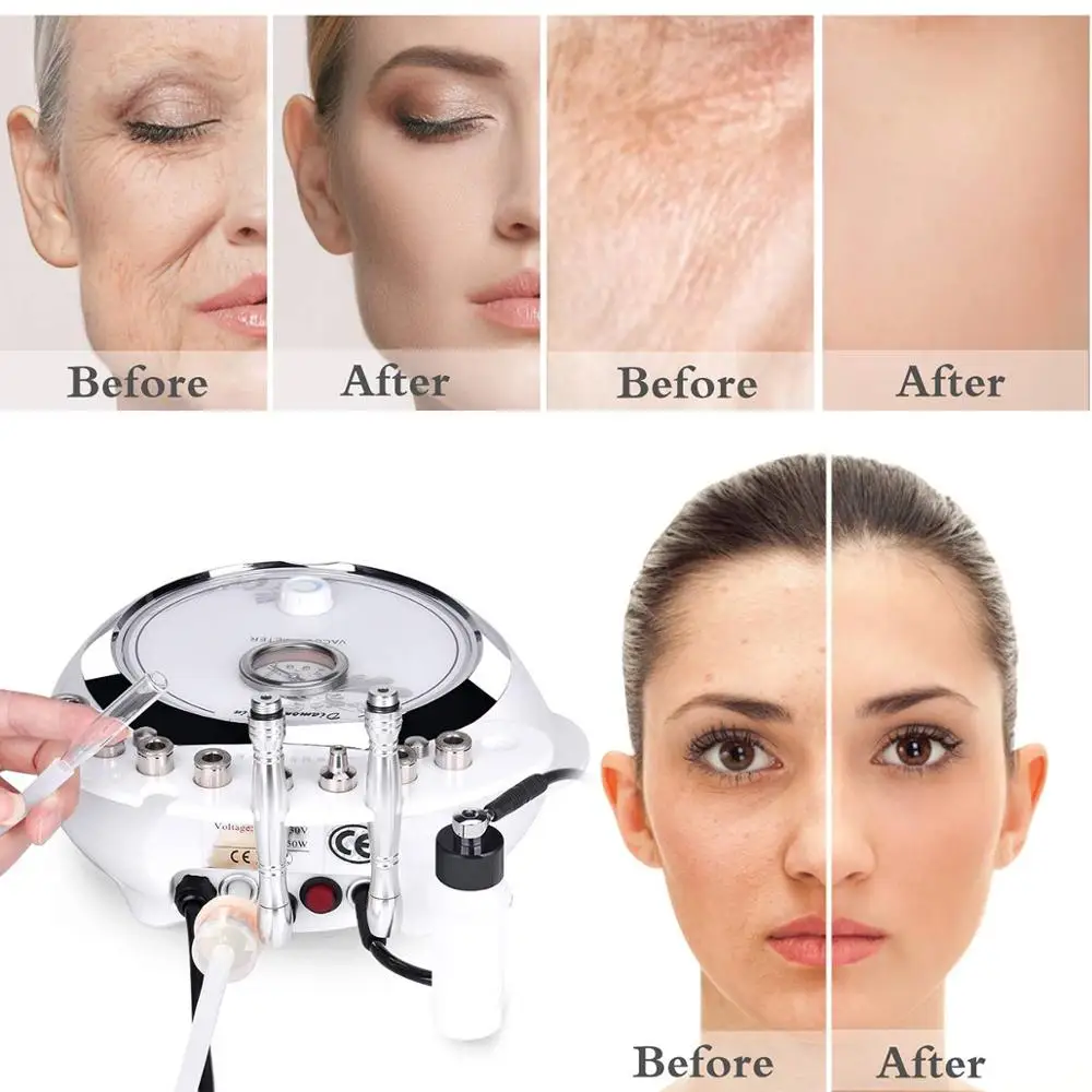 Professional Diamond Microdermabrasion Dermabrasion Machine Home Use Facial Beauty Salon Wrinkle Face Peeling Equipment