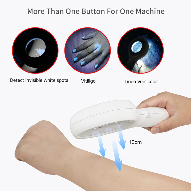 Skin Examination Handheld Skin Fungus Detector Melasma Detector Woods Lamp Versicolor Medical Woods Lamp