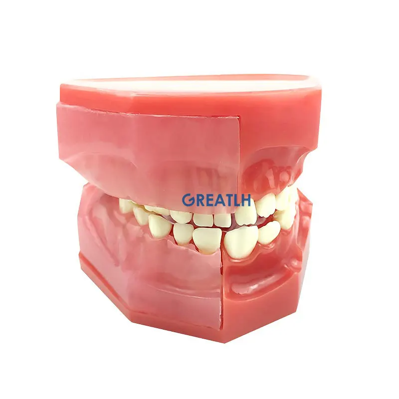 Dental Children 's Deciduous Teeth Replacement Model Milk Permanent Teeth Alternately Display Model Oral Communication Model