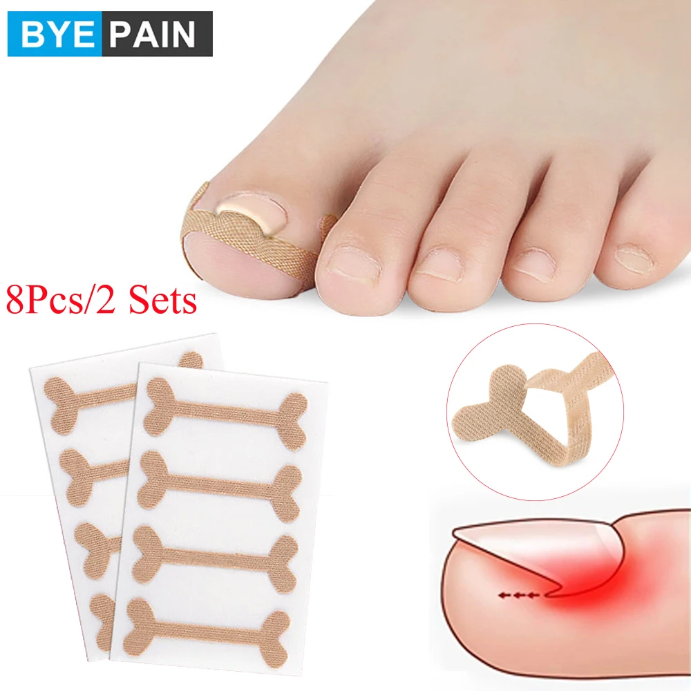 

8Pcs/2Sets Toenail Correction Patch Ingrown Toenails Band Aid Relief Pain Paronychia Correction Pedicure Elastic Force Sticker