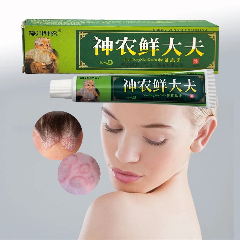 

15g Herbal Material Psoriasis Creams Dermatitis Eczema Pruritus Psoriasis Ointment Body Cream With Retail Box