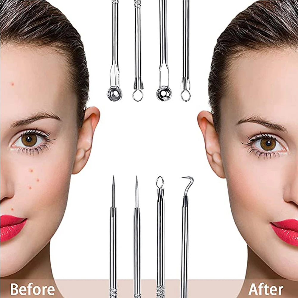 4pcs/set Dual Heads Acne Needle Blackhead Blemish Squeeze Pimple Extractor Remover Spot Cleaner Beauty Skin Care Tool Kit WA 159