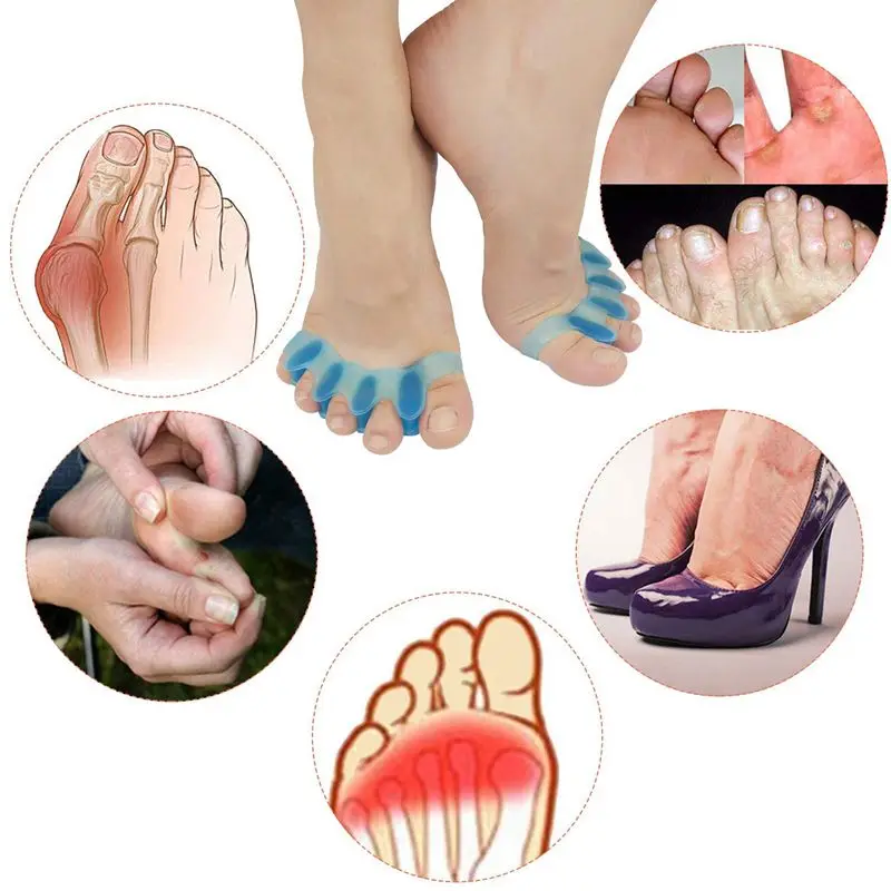 2 stücke = 1 paar Neue Schutz Zehen Separator Geeignet Bunion Corrector Material Weiche Gel Haarglätter Spacer Bahren Pflege werkzeug