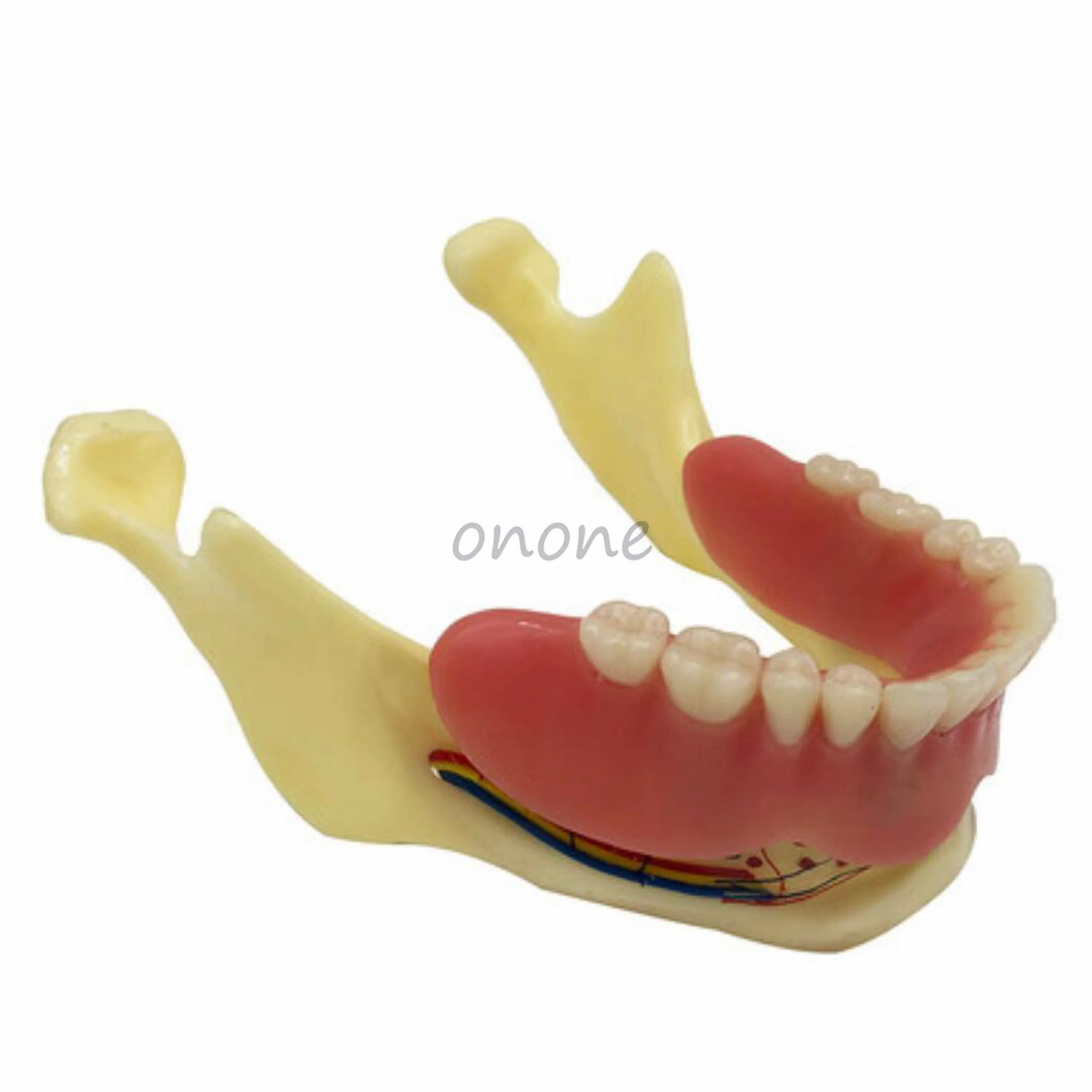 1pcs Dental Implant Denture Restoration Mandible Display Model with 4 Nail Teeth Model