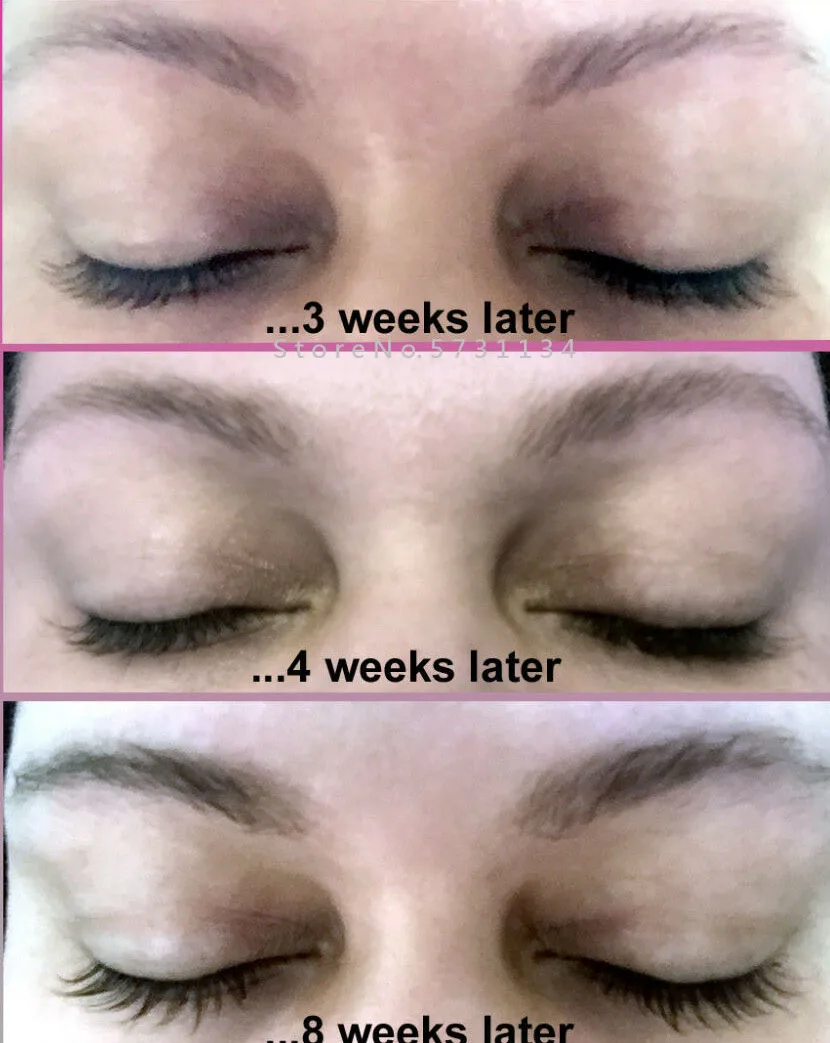 Before and After Best Organic Eyelash Growth Serum Safe for Eyebrows Fast Hair Eyelashes Serum