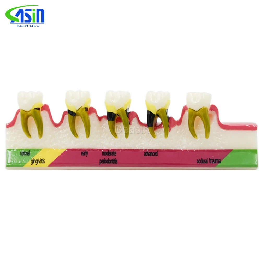 Dental Periodontal Disease assort Teeth Dentoform Typodont Study Teaching Model