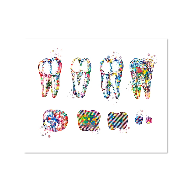 Tooth Implant Art Dental Crown Print Dentist Gift Tooth Anatomy Medical Wall Art Canvas Painting Picture Dental Clinic Decor