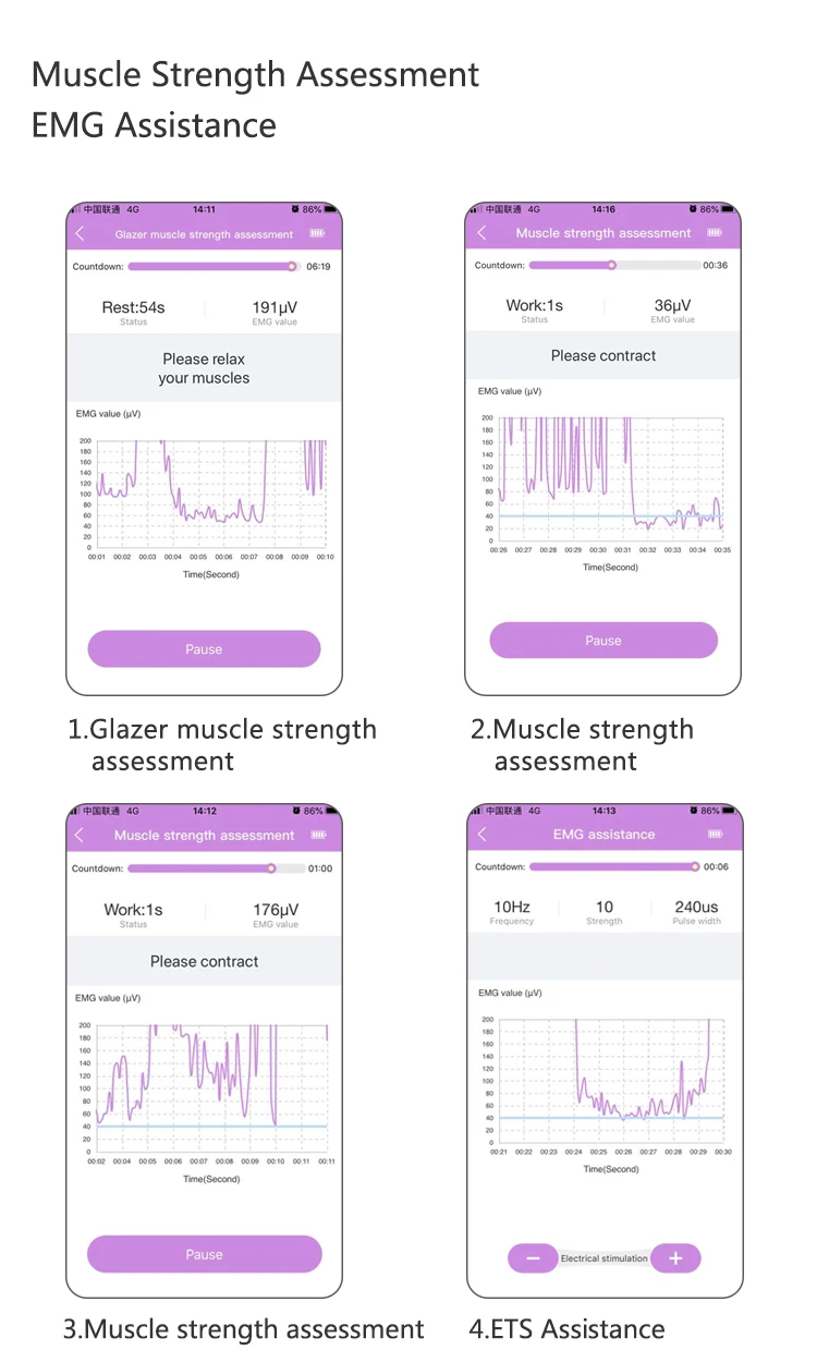 Wireless APP Pelvic Floor Muscle Training for Kegel EMG&ETS Therapy uracratia Pelvic organ prolapse&POP Improve vaginal laxity