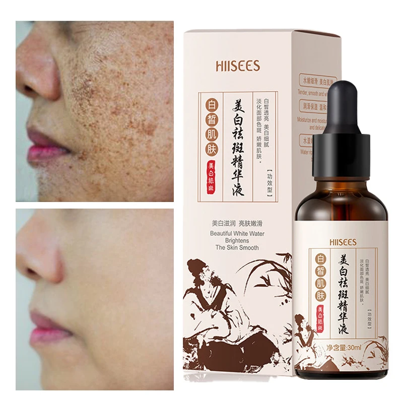 Face Serum Moisturizing Face Care Fade Black Spots Chloasma Sunburn Brighten Skin Tone Deep Nourishment Repair Face Care 30ml