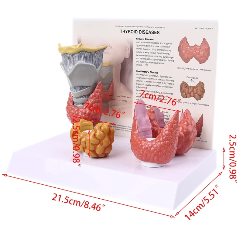 1 Juego de modelo anatómico humano de tamaño real, modelo de glándula de la patología, sistema de anatomía, pantalla de diseño vívido, herramienta de enseñanza de estudio