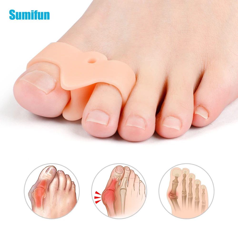 2pcs Two Holes Toe Separator Hallux Valgus Orthopedic Protector Foot Pain Relief Cushion Prevent Toes Overlap Foot Correction