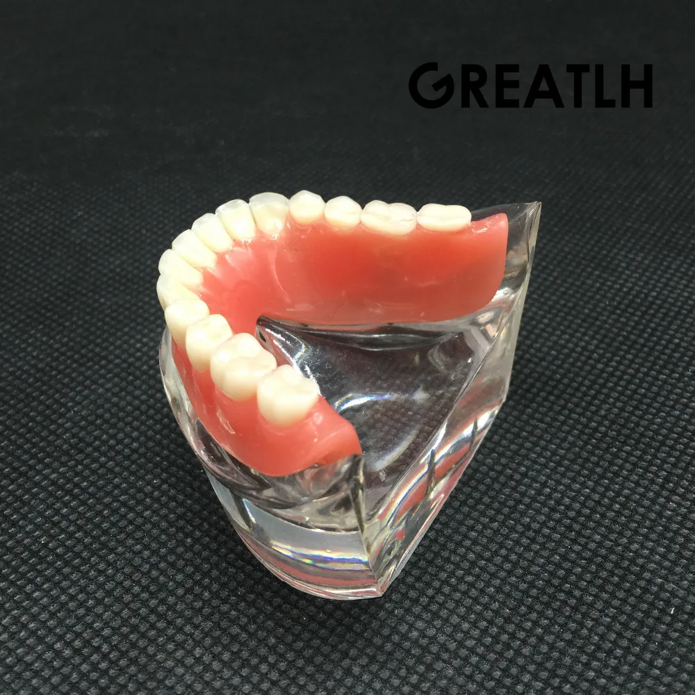 Nha Khoa Overdenture Nội Thất Mandibular Răng Hàm Dưới Mẫu Mandibular Với Giả Phục Hồi Răng Nha Khoa Giảng Dạy Học