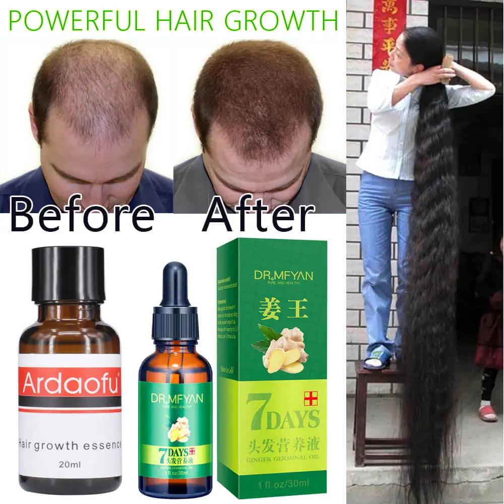 

Powerful Hair Growth Essence Anti Treat Hair Loss Oil Liquid Dense Serum Spray Keratin Treatment Care Product for Women Man 30ml