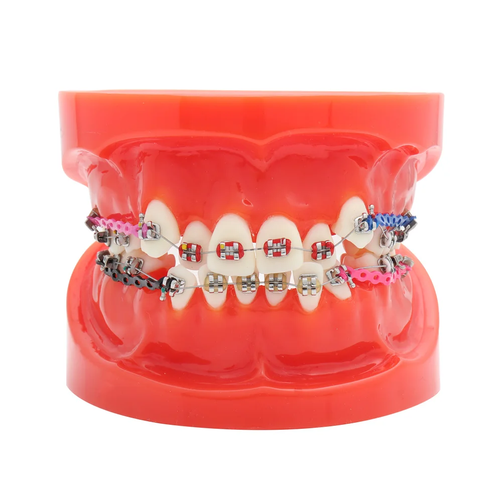 

Dental Standard Orthodontic Teeth Model with Brackets & Buccal Tubes & Ligature Wire Orthodontic Treatment Red