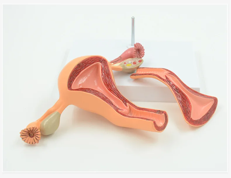 Medical Science Normal/Pathological Uterus Ovary Anatomical Model Anatomy Cross Section Medical teaching supplies