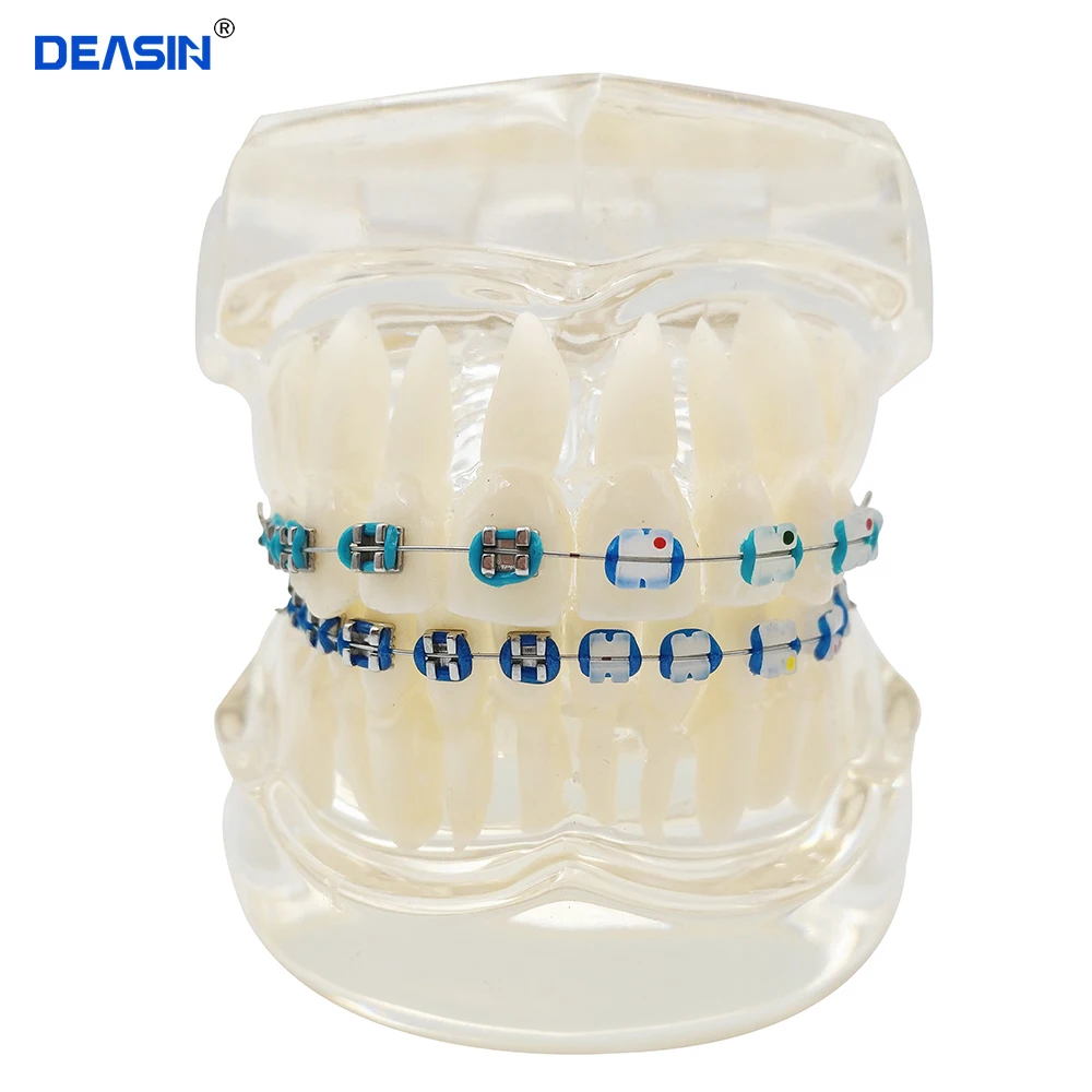 Dental Orthodontics Typodont Teeth Model Half Metal Half Ceramic Brace bracket Typodont with Arch Wire