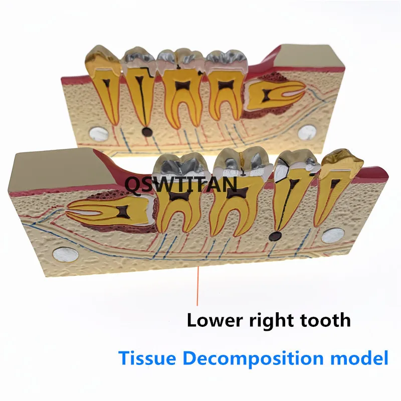 Choroby zębów zęby anatomii Model molowy przekrój rozkładu model w prawym dolnym rogu tylnej model zębów