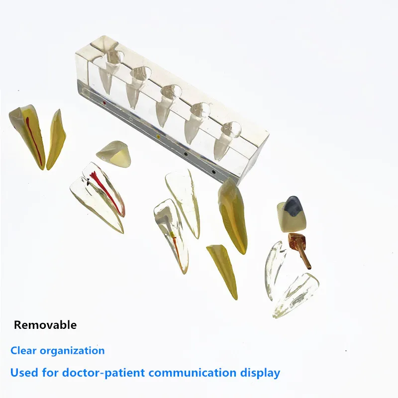 

Dental 5 Stage Endodontic Treatment Model Dental Study Teach Teeth Model