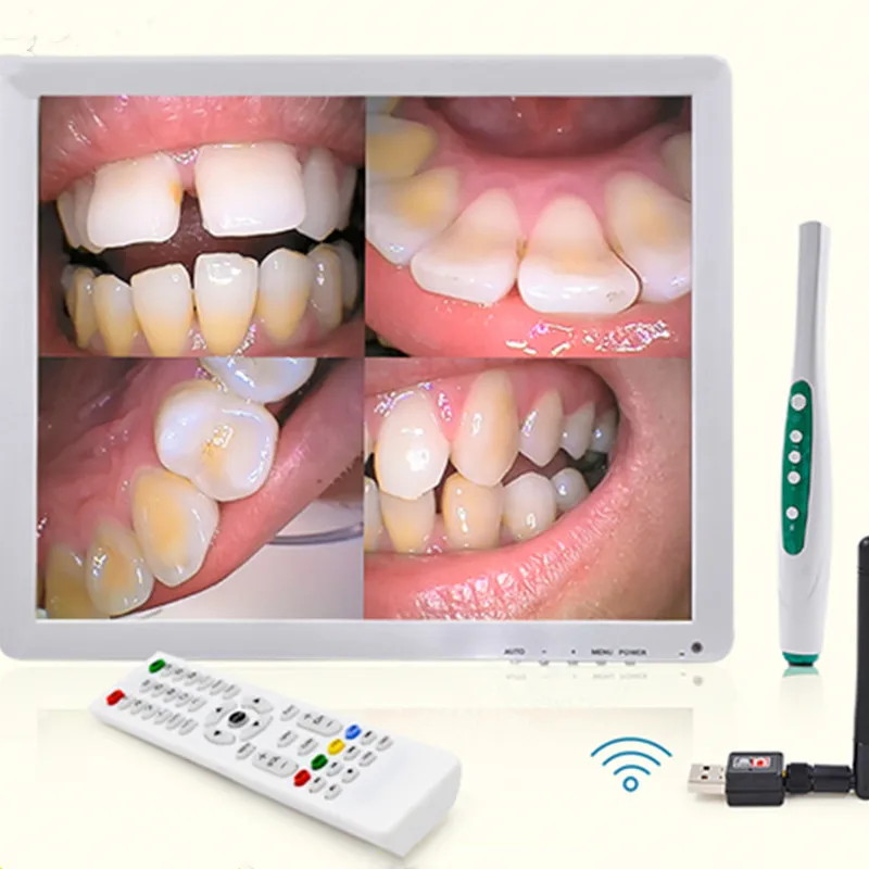 

HD Multimedia Dental Wirless Intraoral Camera System Endoscope Integrated Machine With 17 Inch DIsplay +Holder