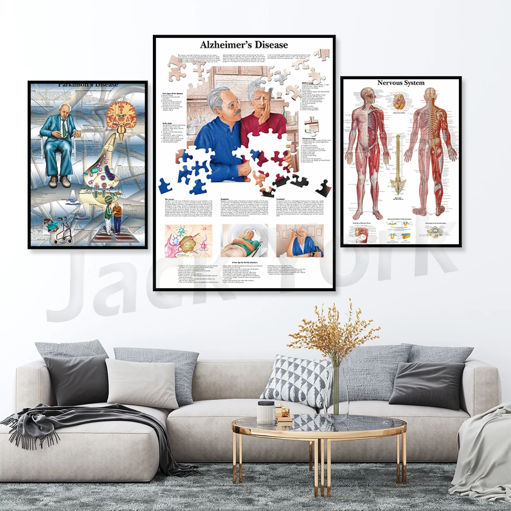 Human Nervous System Chart Poster Map Canvas Painting Wall Pictures for Medical Education Doctors Office Classroom Home Decor