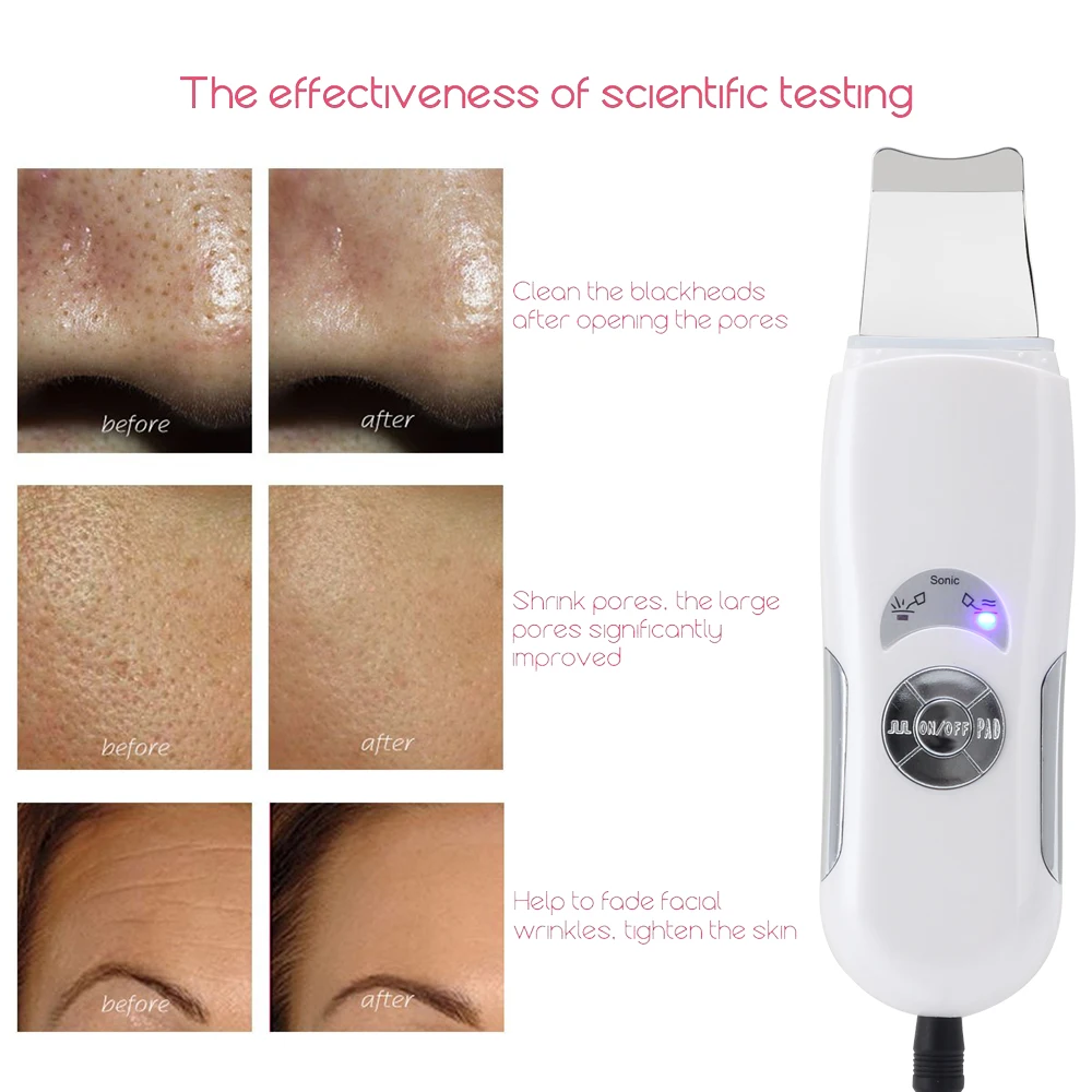 Ultrasonic Skin Scrubber Deep Face Cleaning Machine Peeling Shovel Facial Pore Cleaner Face Skin Lift Machine Mesotherapy