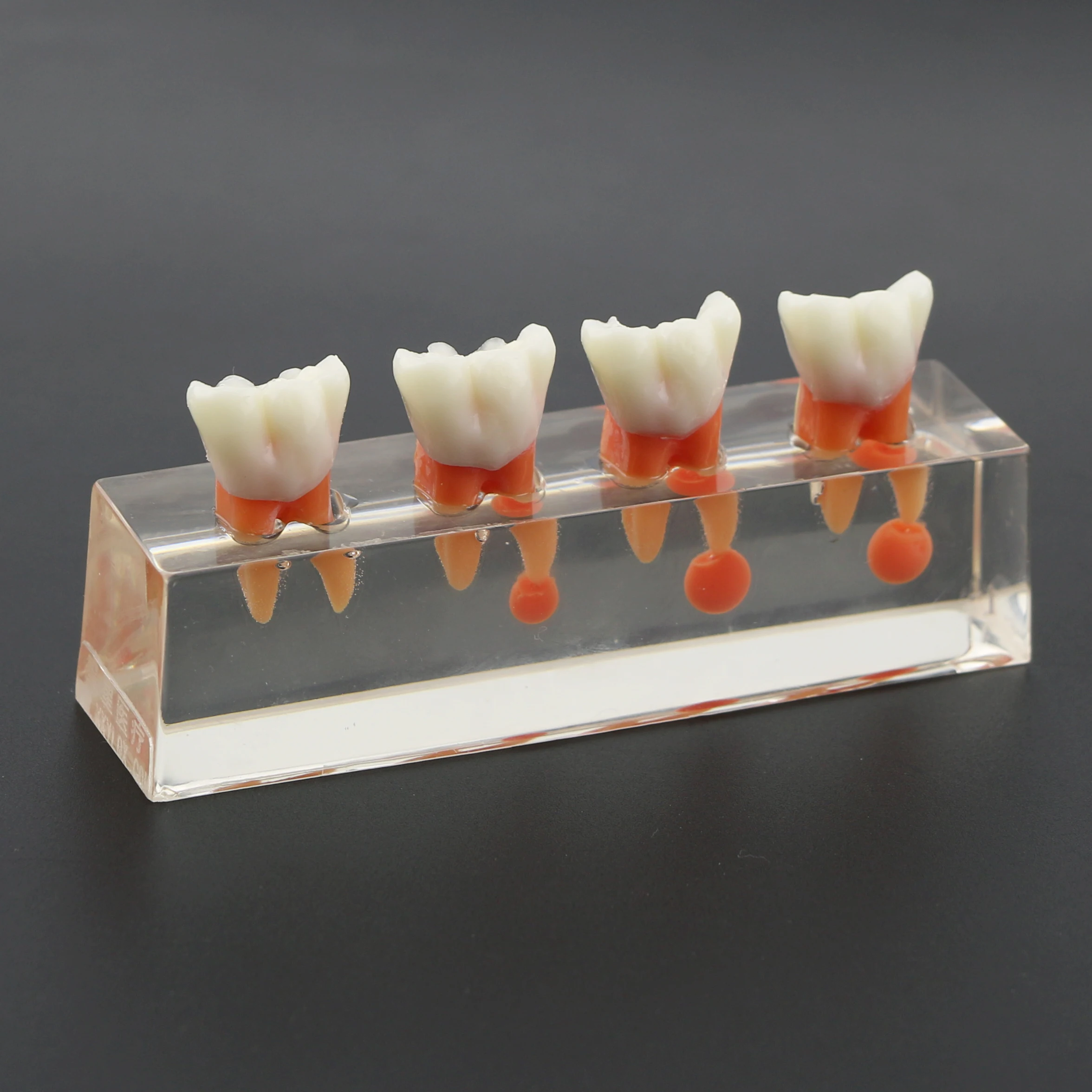 Dental Teeth Model 4-Stage Endodontic Treatment Clear Demonstrates Model for Study Teaching Clinic Decoration