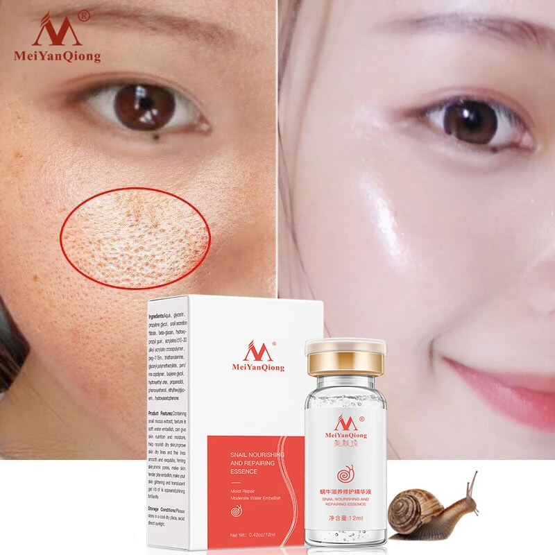 High Quality Snail 100% Pure Plant Extract Hyaluronic Acid Liquid Whitening Blemish Serum Ampoules Anti-acne Rejuvenation Serum