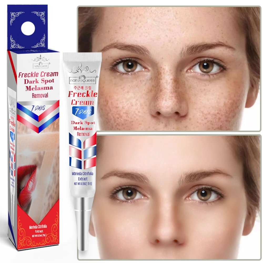 

Instant Whitening Freckle Cream Face Treatment Melasma Remove Dark Spots Pigment Melanin Acne Spot Skin Care Korean cosmetics