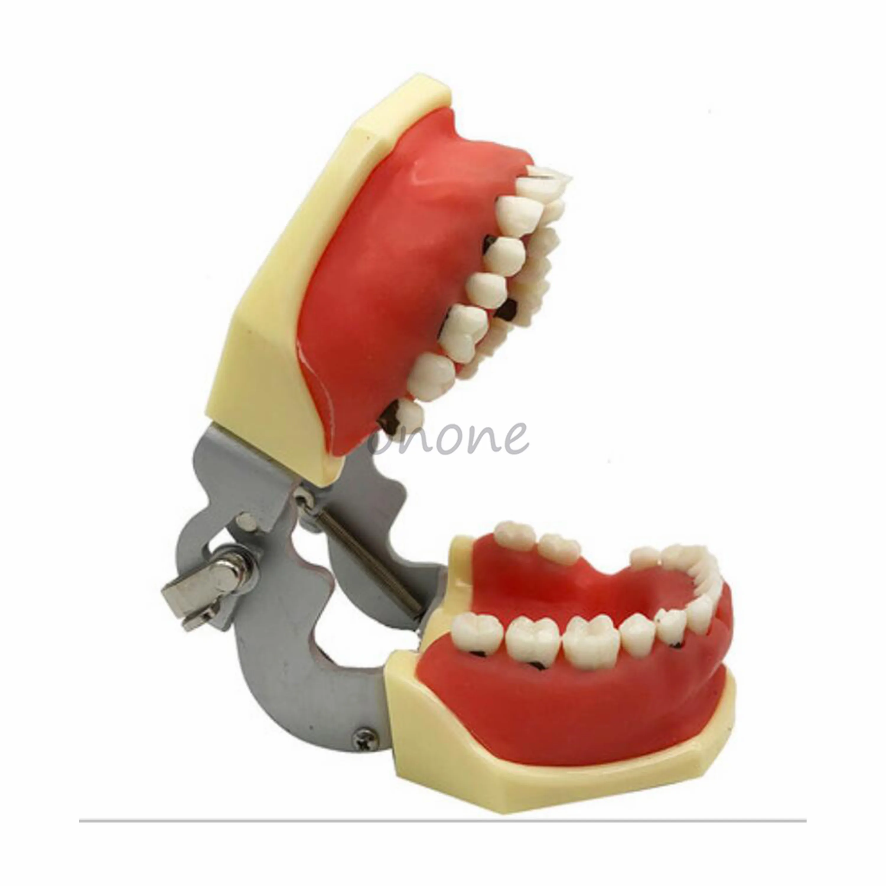 1pcs Periodontal Pathological Model Practice Supragingival Subgingival Scaling Calculus Model Student Learning Teaching Model