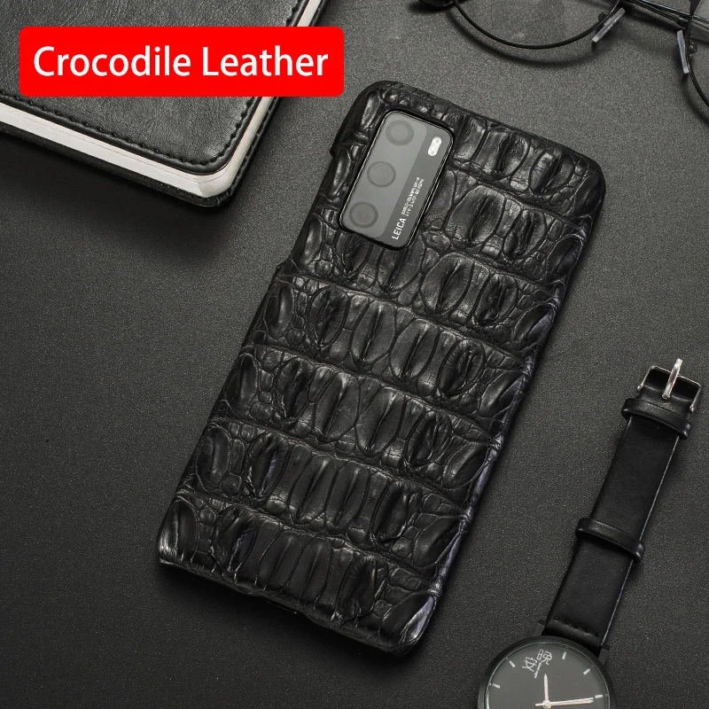 

Natural Crocodile Genuine Leather Phone Case For Huawei Mate 40 RS 30 20 10 P50 P40 P30 Pro P20 Lite Luxury Alligator Back Cover