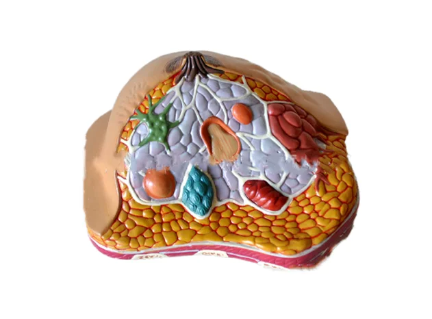 

Human breast lesions pathological anatomy medical teaching model medicine promotion gift display model