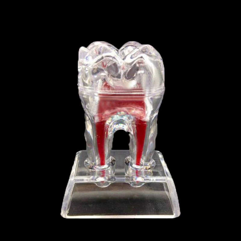 Dental 4 Times Crystal Base Hard Plastic Teeth Tooth Molar Model Separable