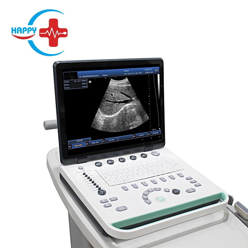 HC-A006A  Hot full digital portable  15inch PC based Laptop  3D  Ultrasound scanner machine