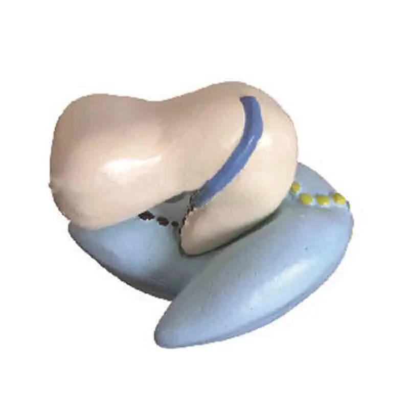 

Ribosome amplification model