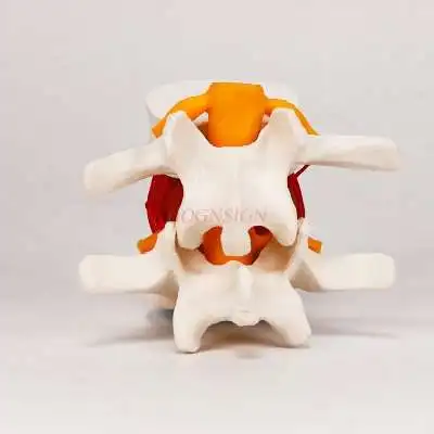 Human lumbar intervertebral disc demonstration model skeletal model Human lumbar spine spine joint model medical