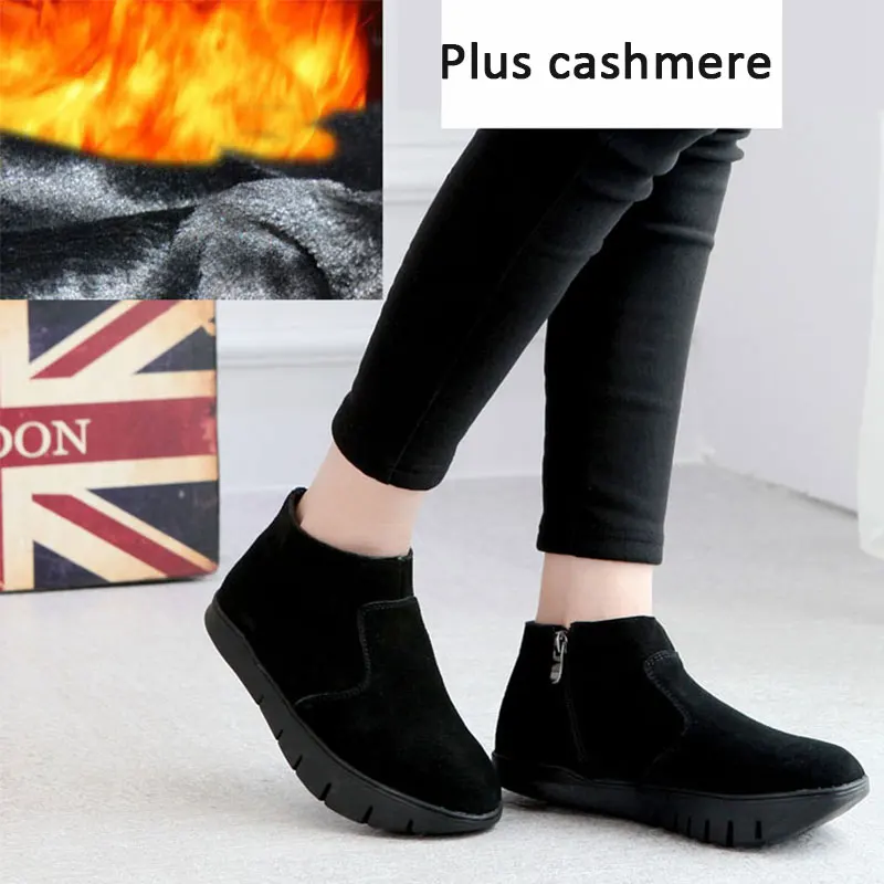 أحذية نسائية احترافية بكعب سلبي على شكل حرف K أحذية نسائية لتقويم العظام للخريف والشتاء من جلد البقر بالإضافة إلى أحذية مخملية متوسطة الجودة من الأمام